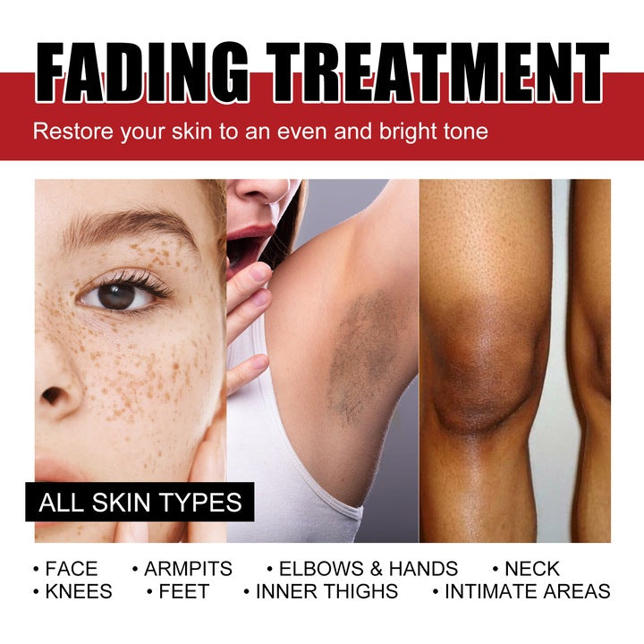 🧴 Krimu ya madoa meusi